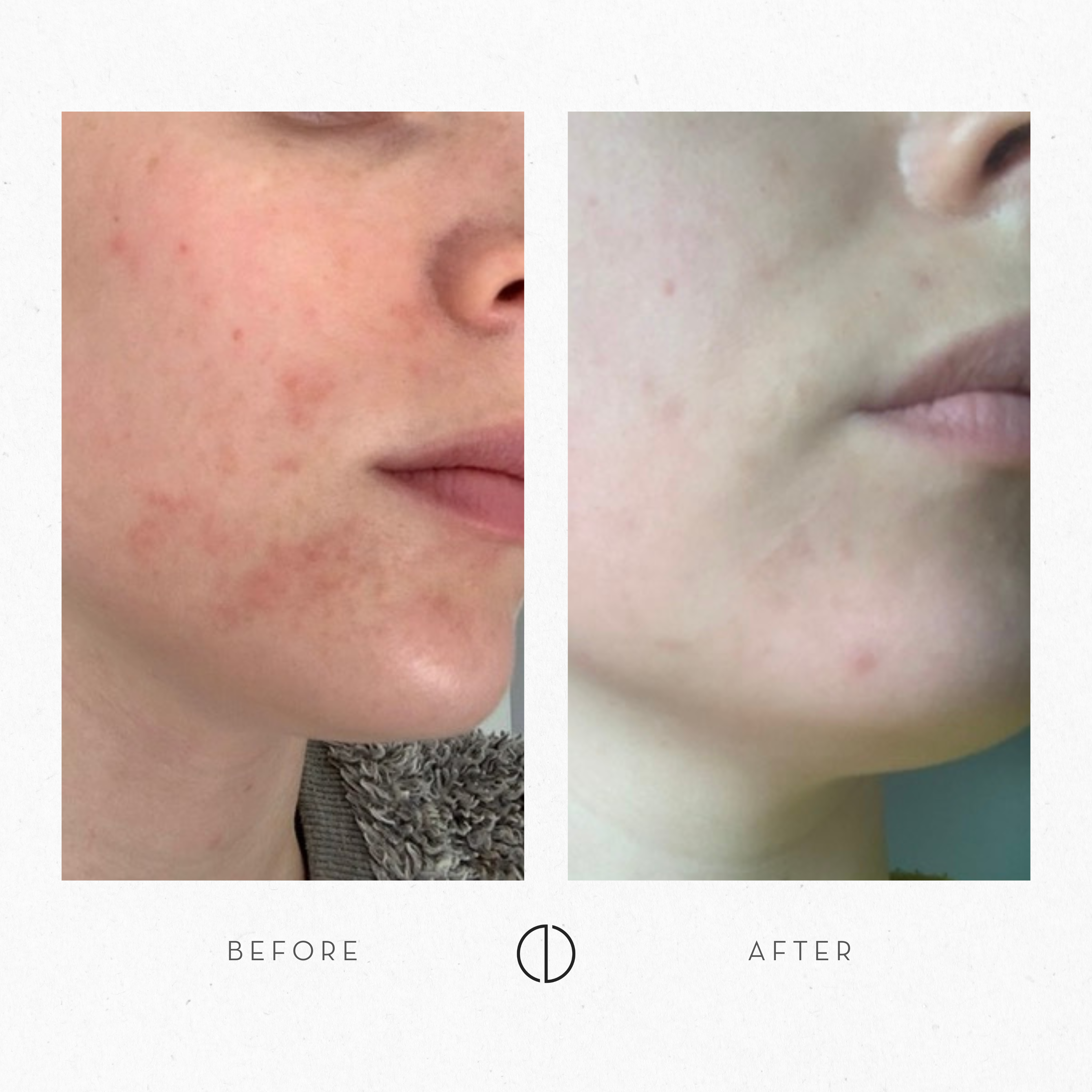 Viivi & Reactive skin