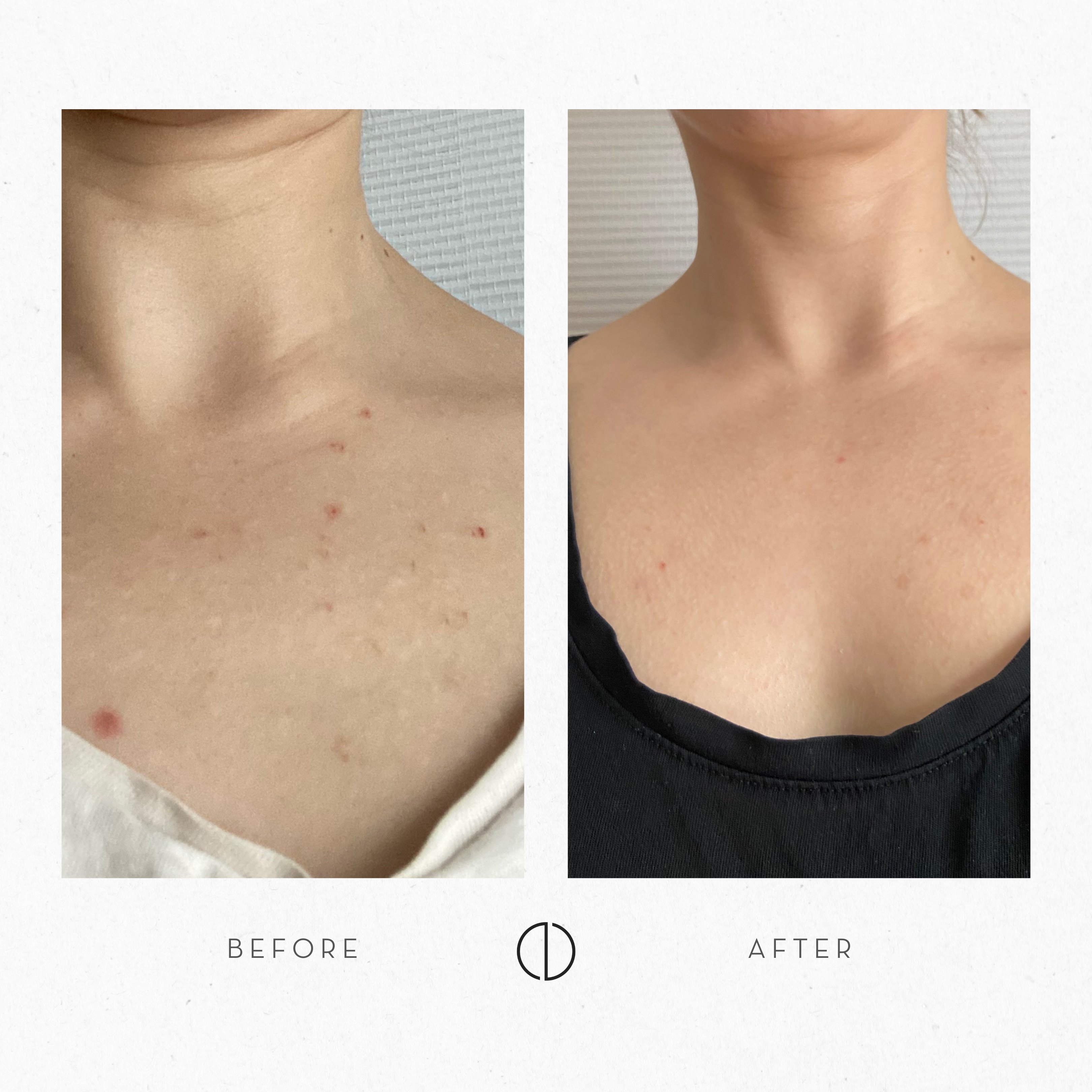 Anu: Dry, congested & reactive skin